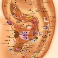 Auriculoterapia